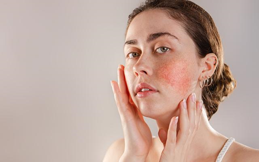 Hypersensitive skin