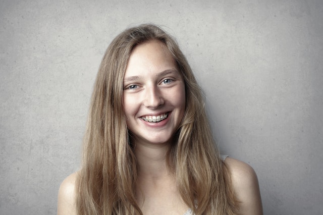 Adults braces