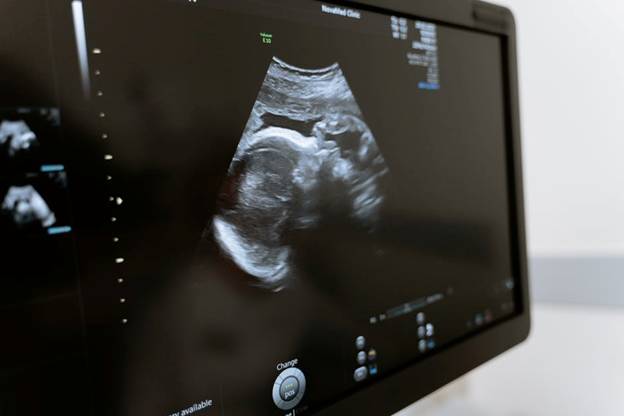 Traveling Ultrasound Tech