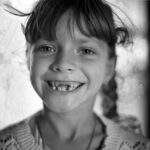 Missing Teeth Replacement