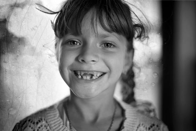Missing Teeth Replacement